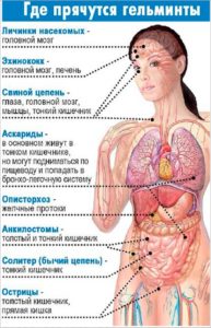 стевия,вывести глистов,борьба с глистами,народные способы борьбы с паразитами,народная медицина,глисты стевия,вывести паразитов,способы борьбы с паразитами